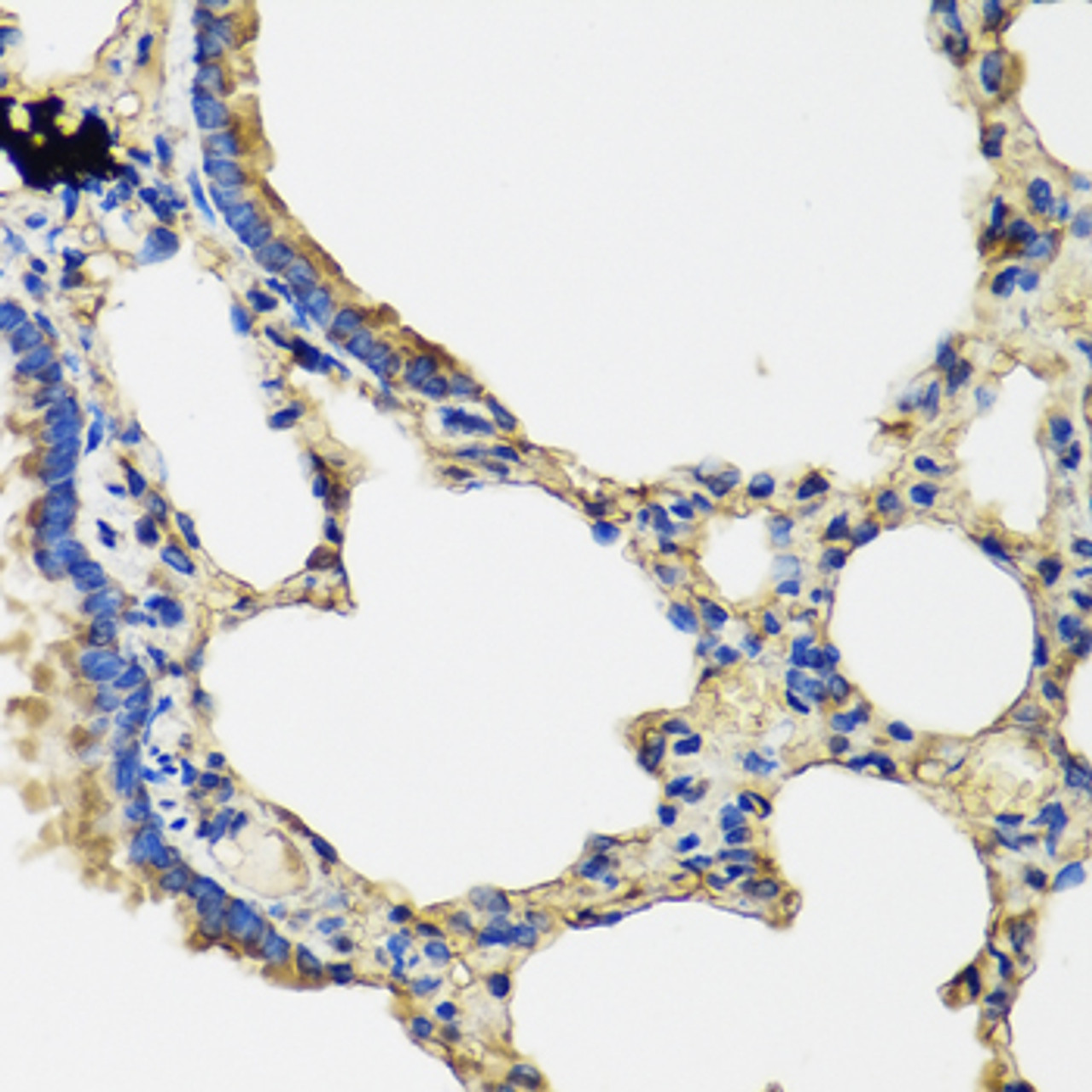 Immunohistochemistry of paraffin-embedded Rat lung using IL36G Polyclonal Antibody at dilution of  1:100 (40x lens).