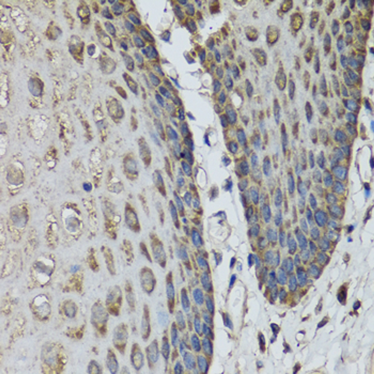 Immunohistochemistry of paraffin-embedded Human esophagus using IL36G Polyclonal Antibody at dilution of  1:100 (40x lens).