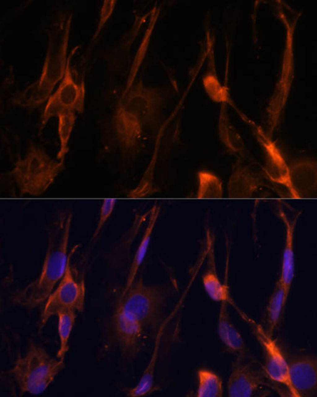 Immunofluorescence analysis of C6 cells using BFAR Polyclonal Antibody at dilution of  1:100 (40x lens). Blue: DAPI for nuclear staining.