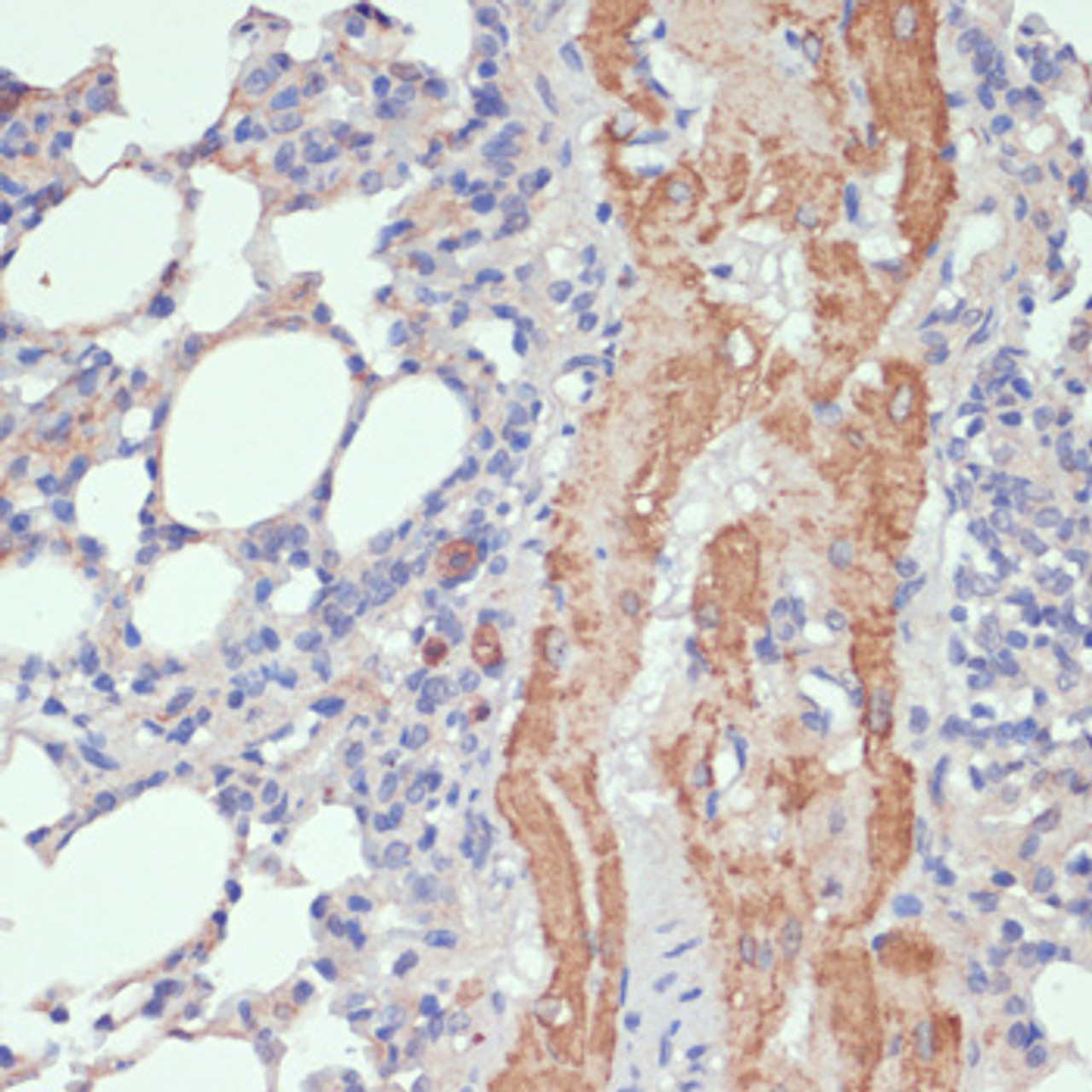 Immunohistochemistry of paraffin-embedded Rat lung using WNT5B Polyclonal Antibody at dilution of  1:100 (40x lens).
