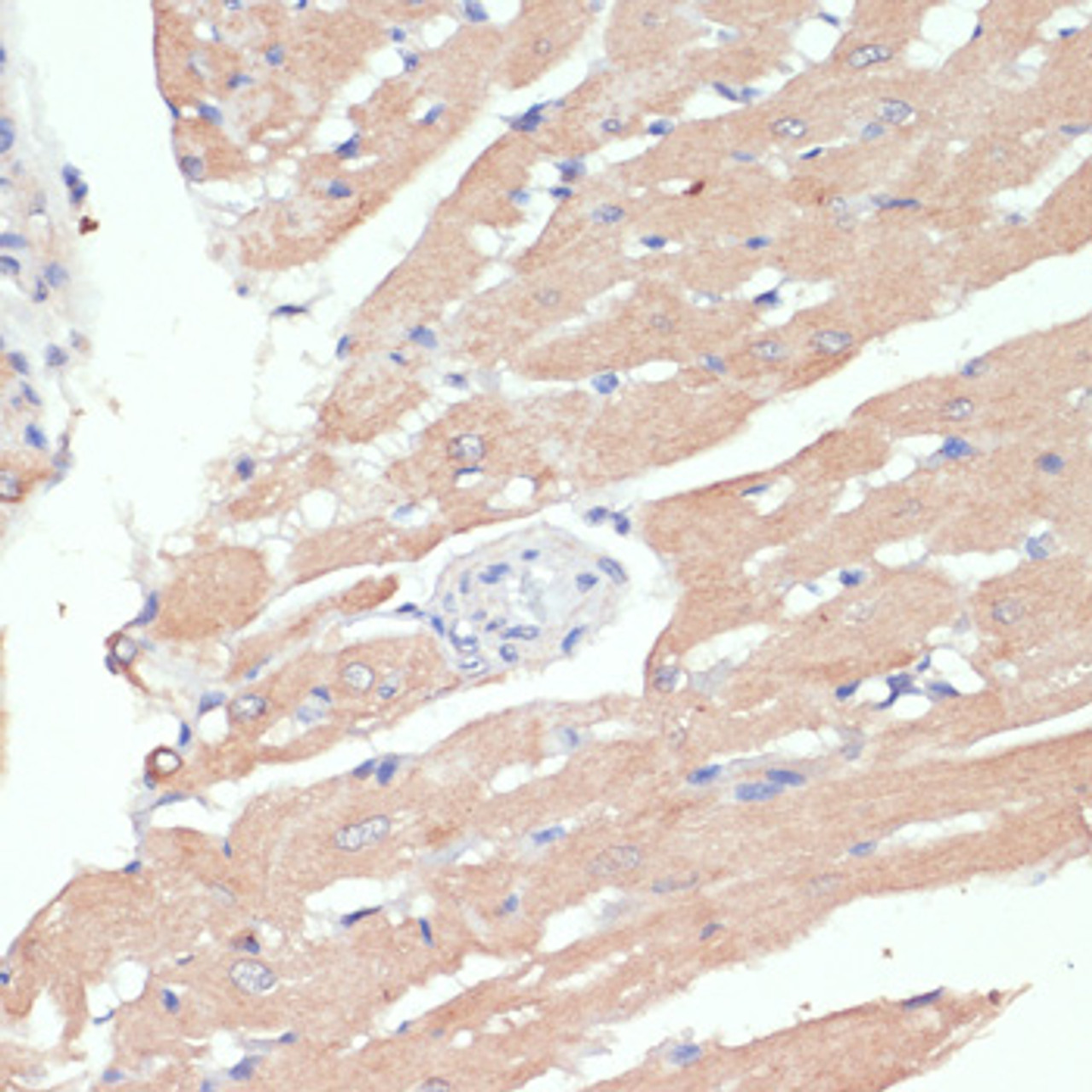 Immunohistochemistry of paraffin-embedded Rat heart using WNT5B Polyclonal Antibody at dilution of  1:100 (40x lens).