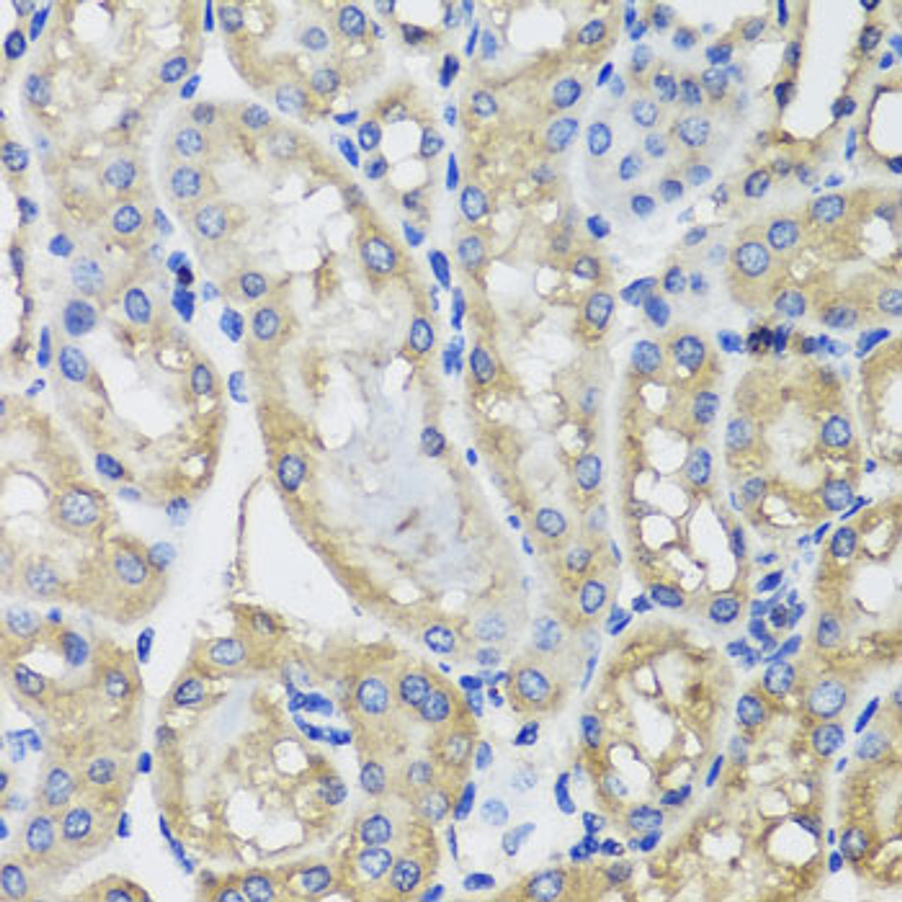 Immunohistochemistry of paraffin-embedded Mouse kidney using MRPS22 Polyclonal Antibody at dilution of  1:100 (40x lens).