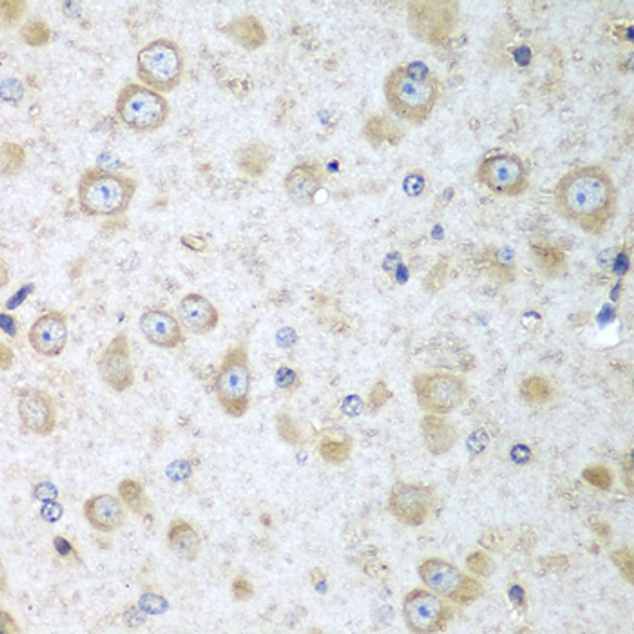 Immunohistochemistry of paraffin-embedded Mouse brain using TRH Polyclonal Antibody at dilution of  1:100 (40x lens).