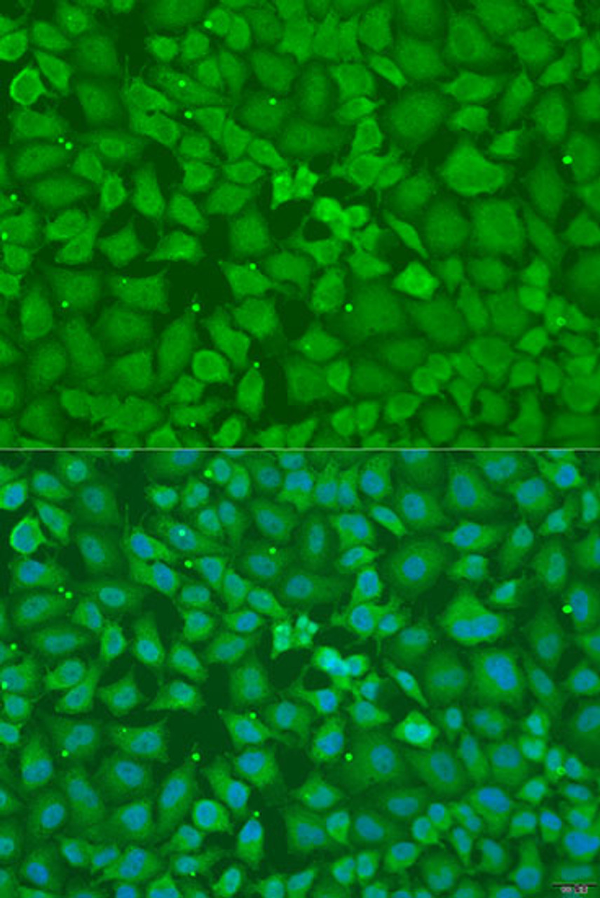 Immunofluorescence analysis of U2OS cells using TRH Polyclonal Antibody at dilution of  1:100. Blue: DAPI for nuclear staining.