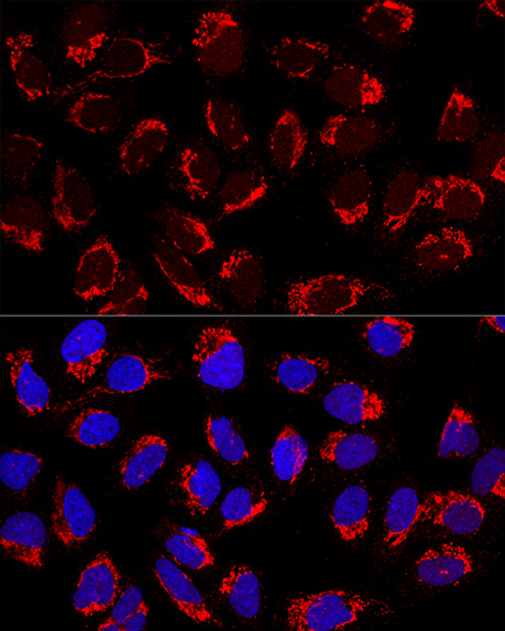 Confocal immunofluorescence analysis of U2OS cells using AP1M2 Polyclonal Antibody at dilution of  1:200. Blue: DAPI for nuclear staining.