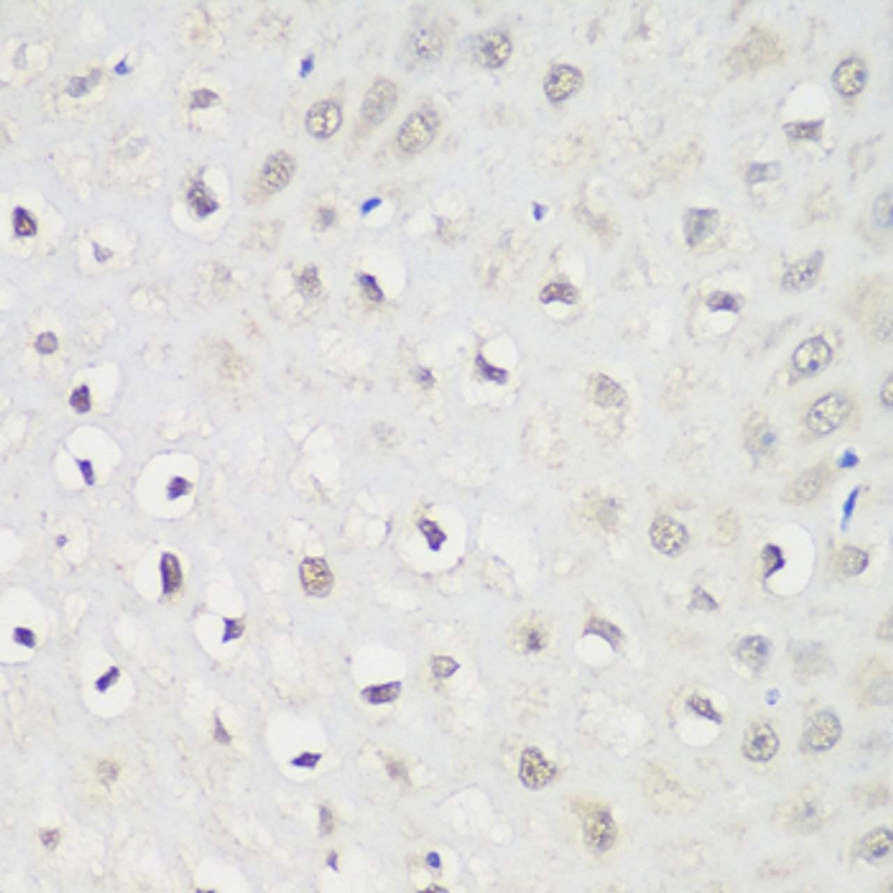 Immunohistochemistry of paraffin-embedded Human esophagus using KPNA3 Polyclonal Antibody at dilution of  1:100 (40x lens).