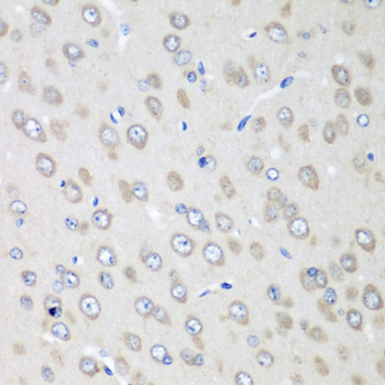 Immunohistochemistry of paraffin-embedded Rat brain using RPN2 Polyclonal Antibody at dilution of  1:100 (40x lens).