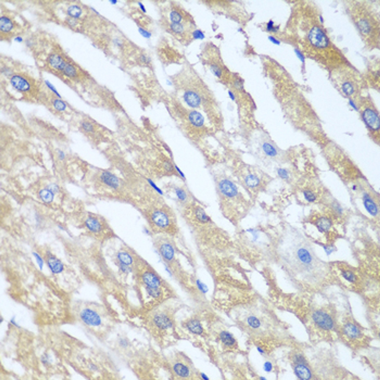 Immunohistochemistry of paraffin-embedded Human liver using PPP4R1 Polyclonal Antibody at dilution of  1:100 (40x lens).