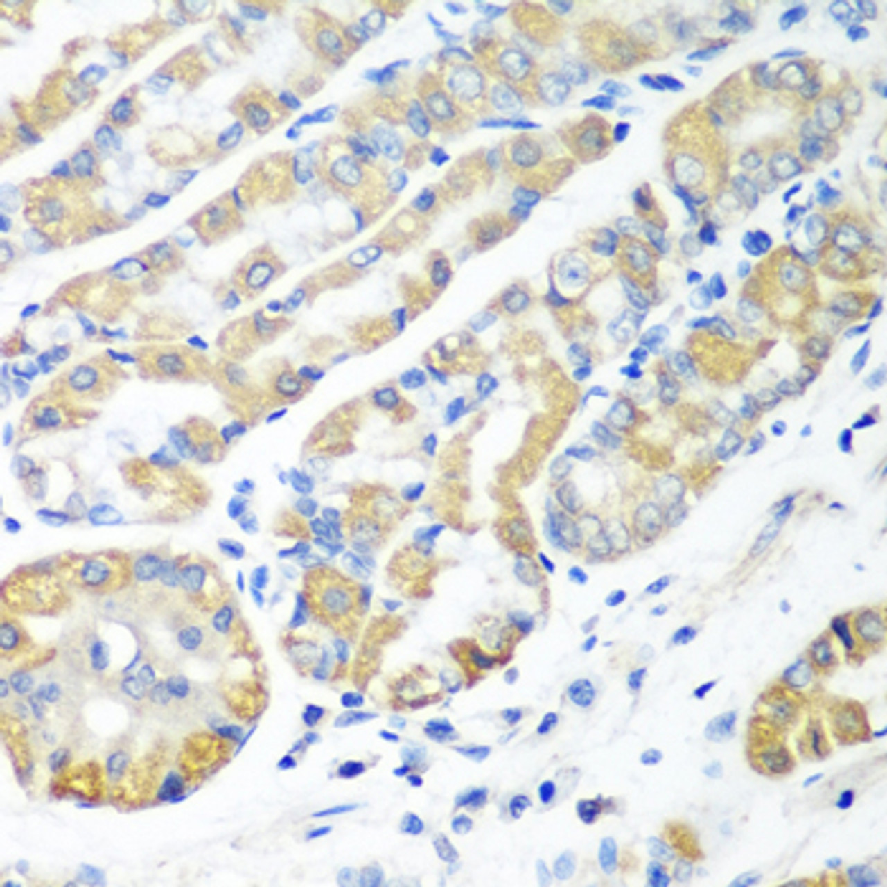 Immunohistochemistry of paraffin-embedded Human stomach using MSRB2 Polyclonal Antibody at dilution of  1:100 (40x lens).