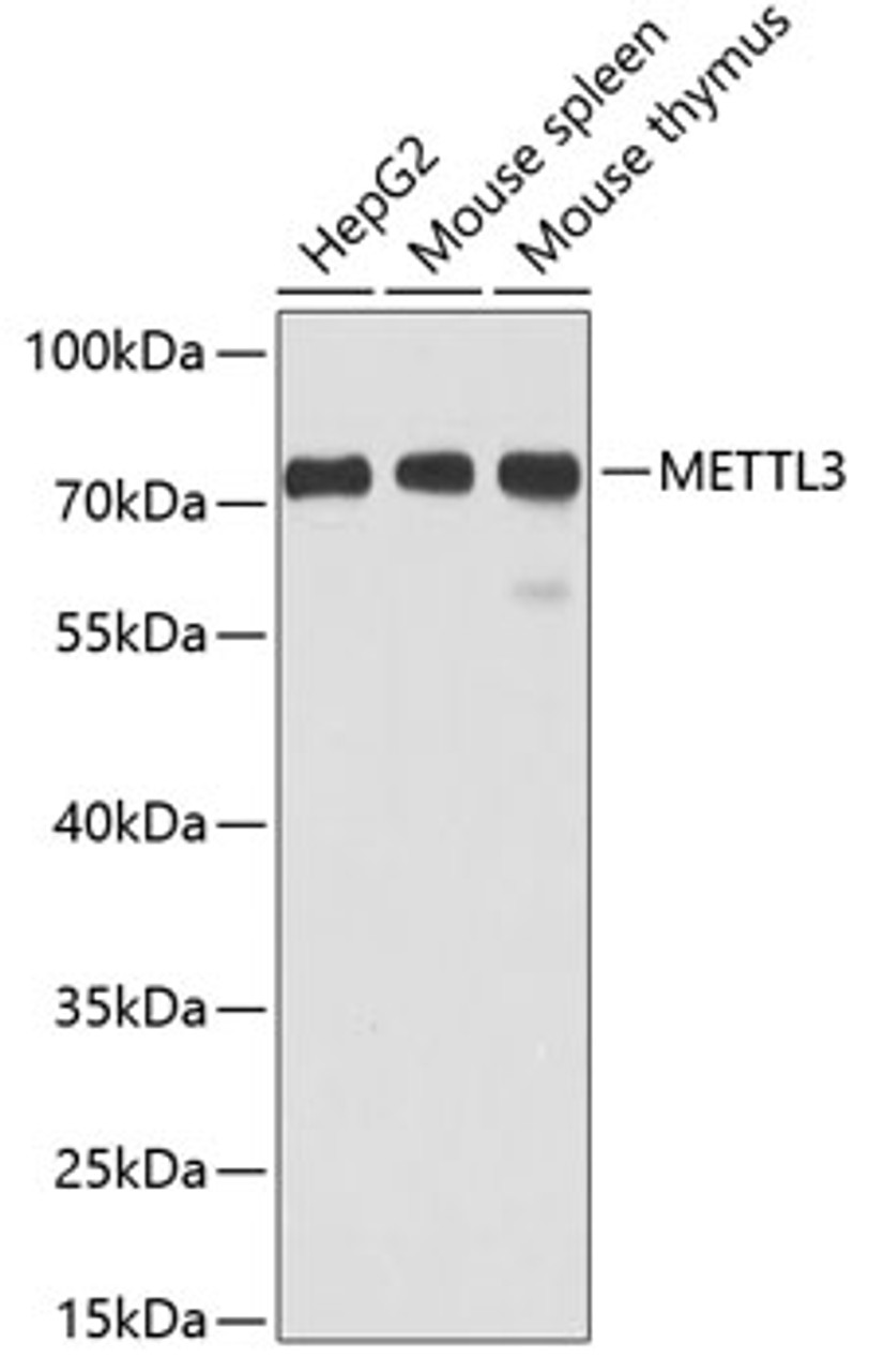 Western blot analysis of extracts of various cell lines using METTL3 Polyclonal Antibody at dilution of 1:1000.