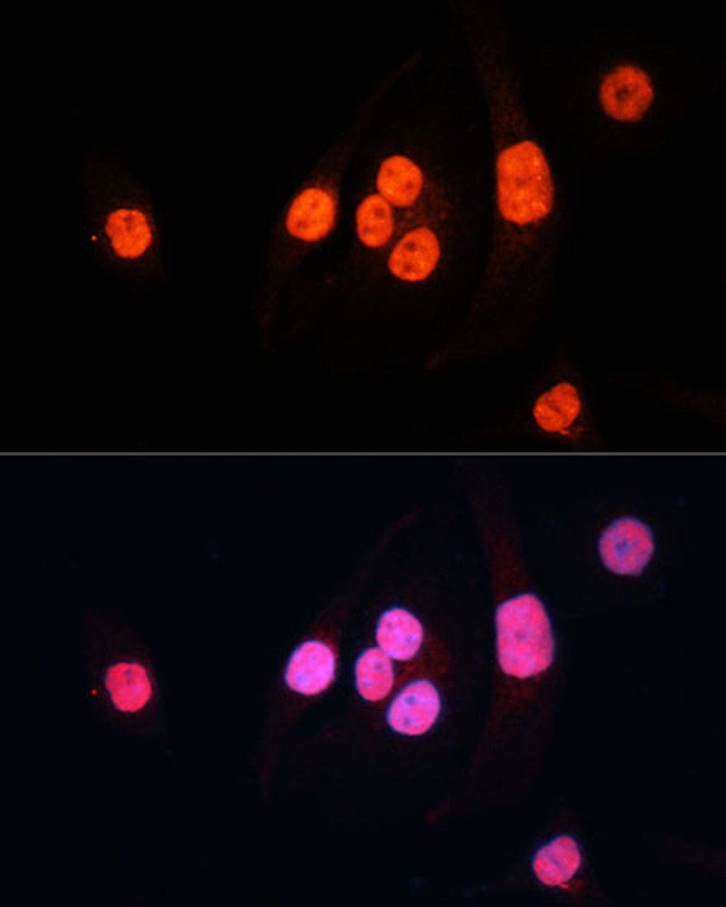Immunofluorescence analysis of HeLa cells using METTL3 Polyclonal Antibody at dilution of  1:100 (40x lens). Blue: DAPI for nuclear staining.