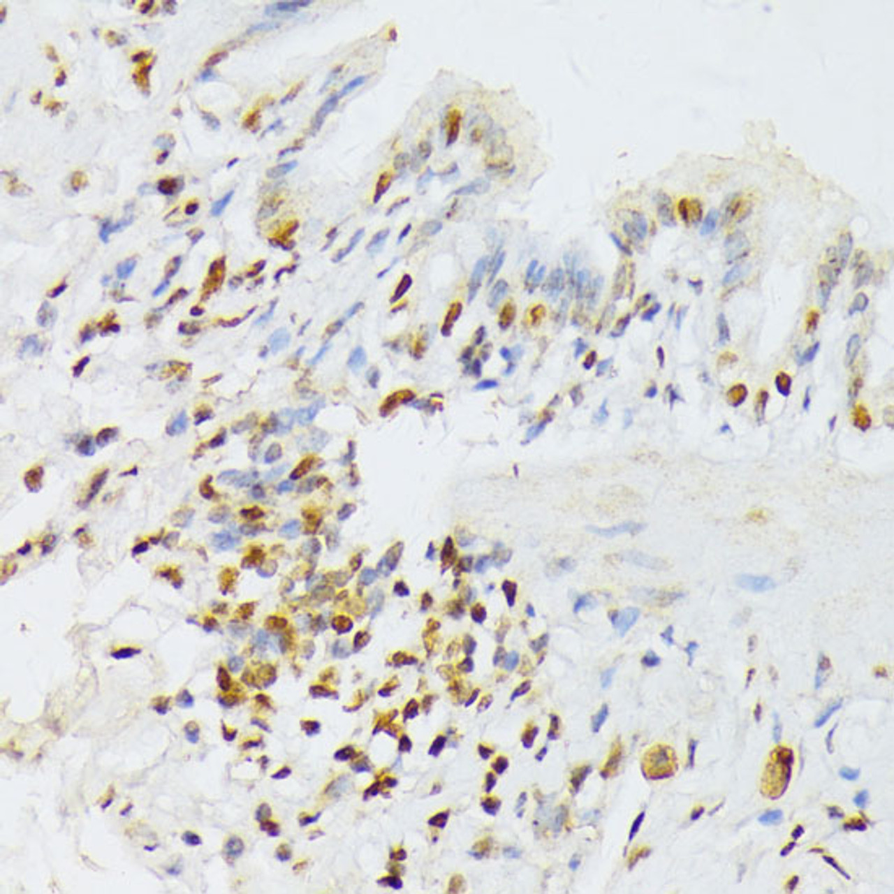 Immunohistochemistry of paraffin-embedded Rat lung using ANKRD52 Polyclonal Antibody at dilution of  1:100 (40x lens).