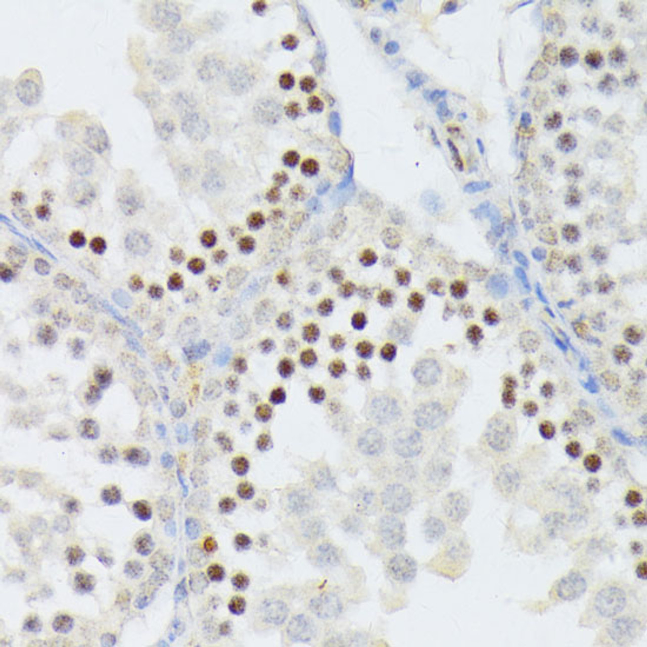 Immunohistochemistry of paraffin-embedded Mouse testis using ANKRD52 Polyclonal Antibody at dilution of  1:100 (40x lens).