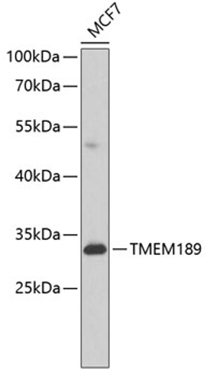Western blot analysis of extracts of MCF-7 cells using TMEM189 Polyclonal Antibody at dilution of 1:1000.