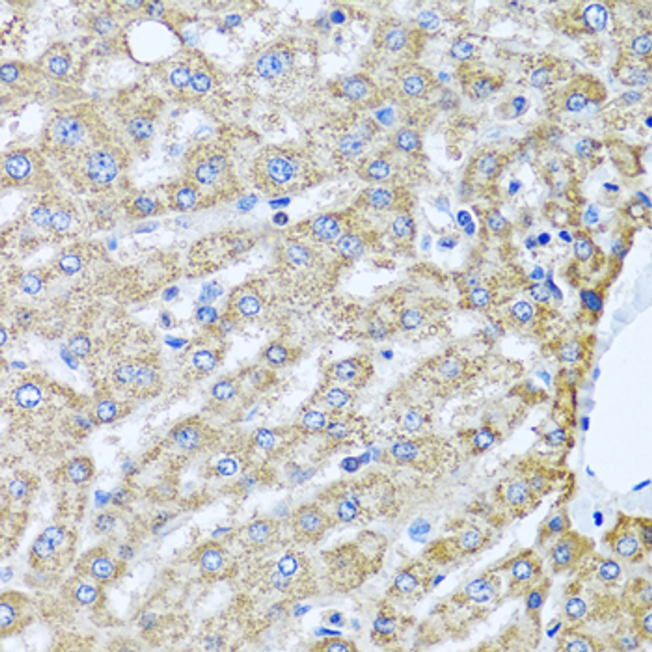 Immunohistochemistry of paraffin-embedded Human liver using TMEM189 Polyclonal Antibody at dilution of  1:100 (40x lens).