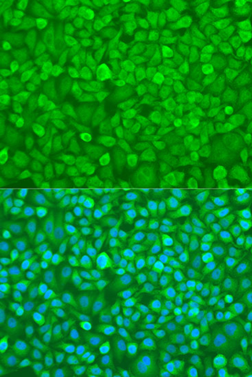 Immunofluorescence analysis of U2OS cells using YTHDF3 Polyclonal Antibody at dilution of  1:100. Blue: DAPI for nuclear staining.