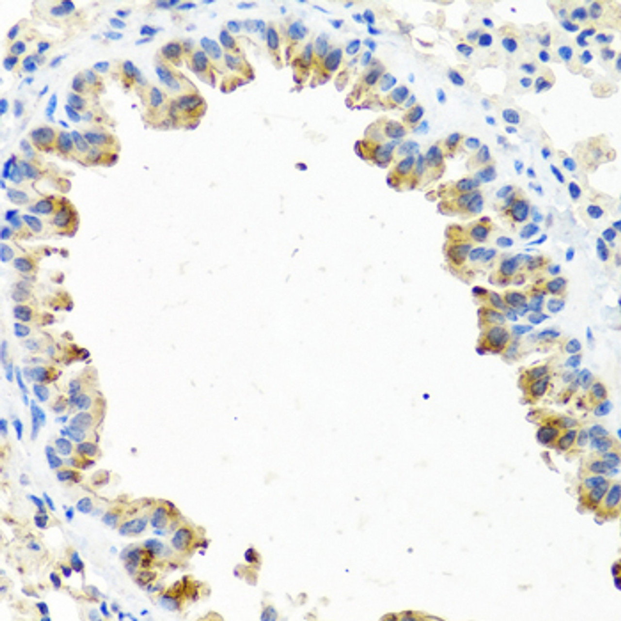 Immunohistochemistry of paraffin-embedded Mouse lung using GNRH2 Polyclonal Antibody at dilution of  1:100 (40x lens).