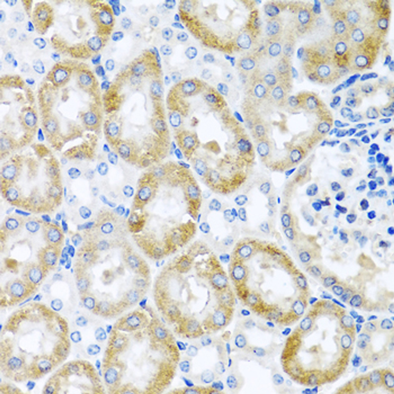 Immunohistochemistry of paraffin-embedded Mouse kidney using GNRH2 Polyclonal Antibody at dilution of  1:100 (40x lens).