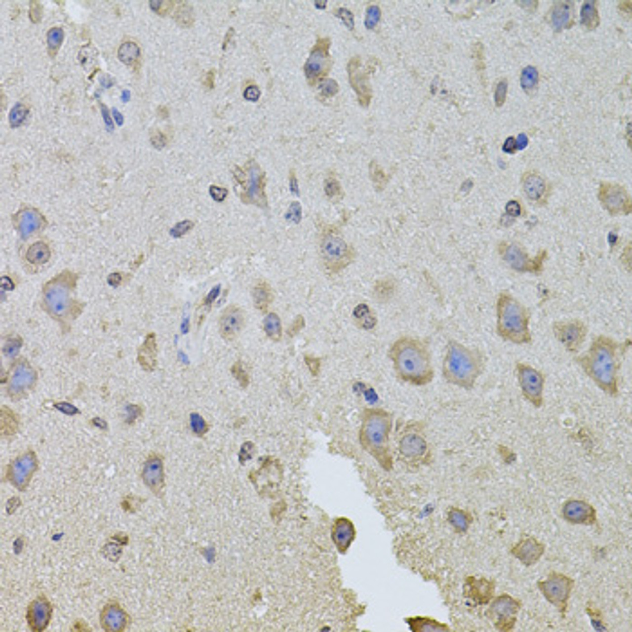 Immunohistochemistry of paraffin-embedded Mouse brain using ITGB8 Polyclonal Antibody at dilution of  1:100 (40x lens).