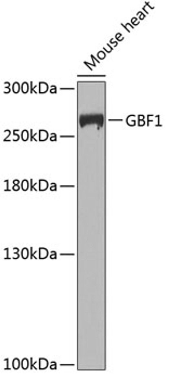 Western blot analysis of extracts of Mouse heart using GBF1 Polyclonal Antibody at dilution of 1:1000.