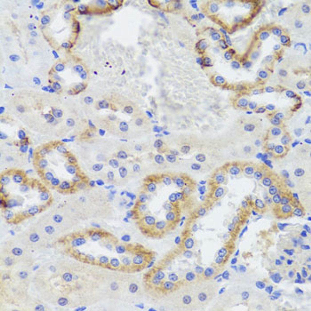 Immunohistochemistry of paraffin-embedded Rat kidney using SYNPO Polyclonal Antibody at dilution of  1:100 (40x lens).