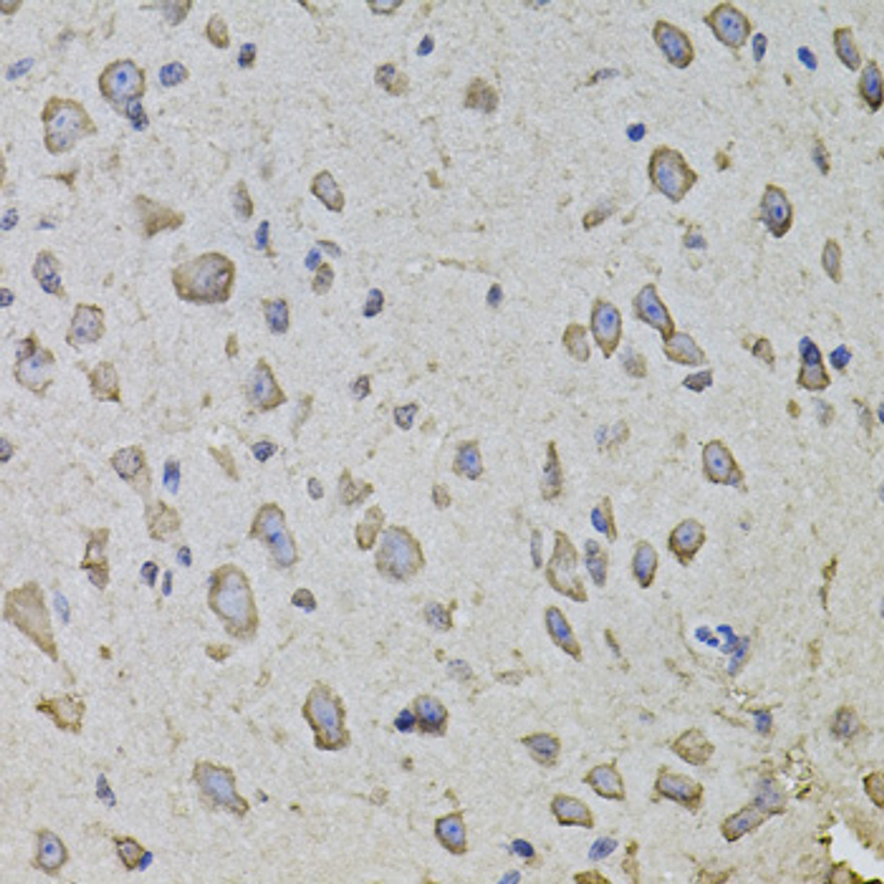 Immunohistochemistry of paraffin-embedded Mouse brain using ARHGEF3 Polyclonal Antibody at dilution of  1:100 (40x lens).