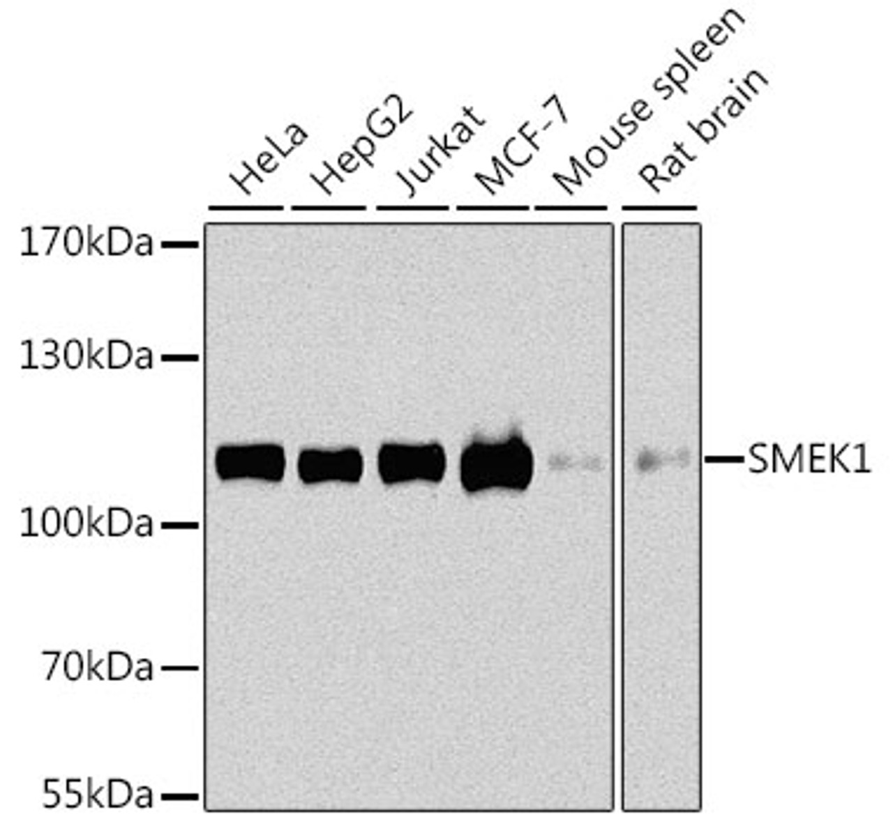 Western blot analysis of extracts of various cell lines using SMEK1 Polyclonal Antibody at dilution of 1:1000.