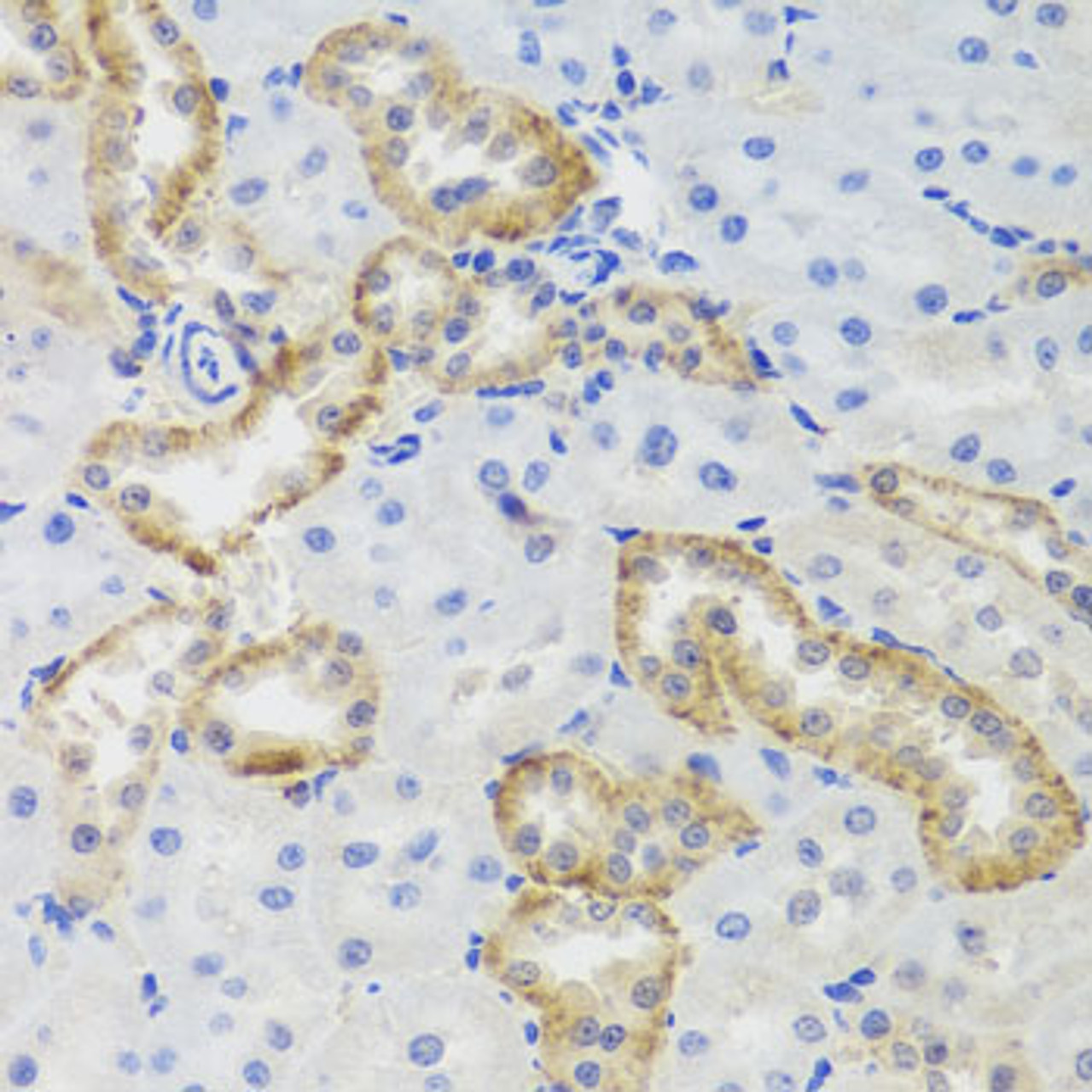 Immunohistochemistry of paraffin-embedded Rat kidney using MTERFD3 Polyclonal Antibody at dilution of  1:100 (40x lens).