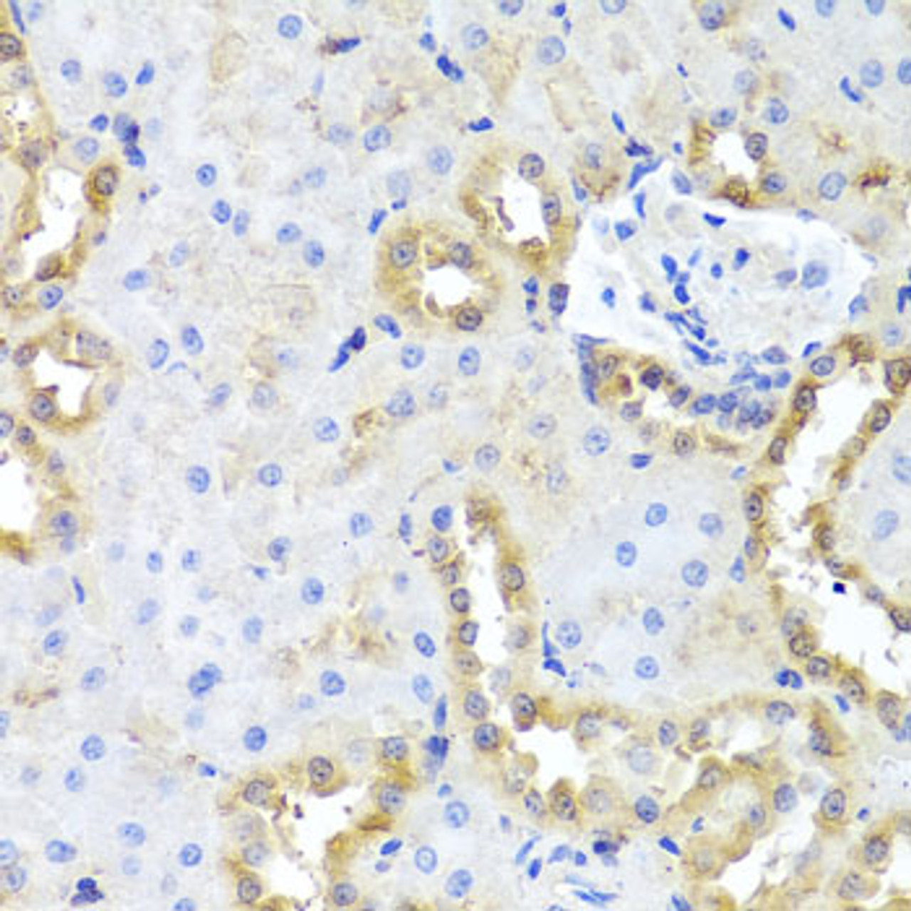 Immunohistochemistry of paraffin-embedded Rat kidney using CGB7 Polyclonal Antibody at dilution of  1:100 (40x lens).