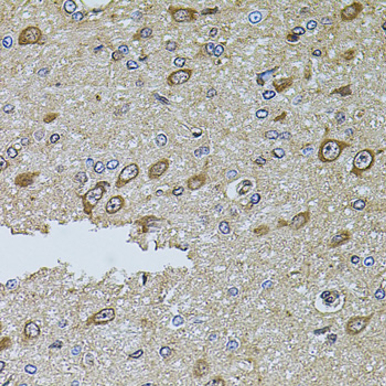 Immunohistochemistry of paraffin-embedded Rat brain using MTIF3 Polyclonal Antibody at dilution of  1:100 (40x lens).