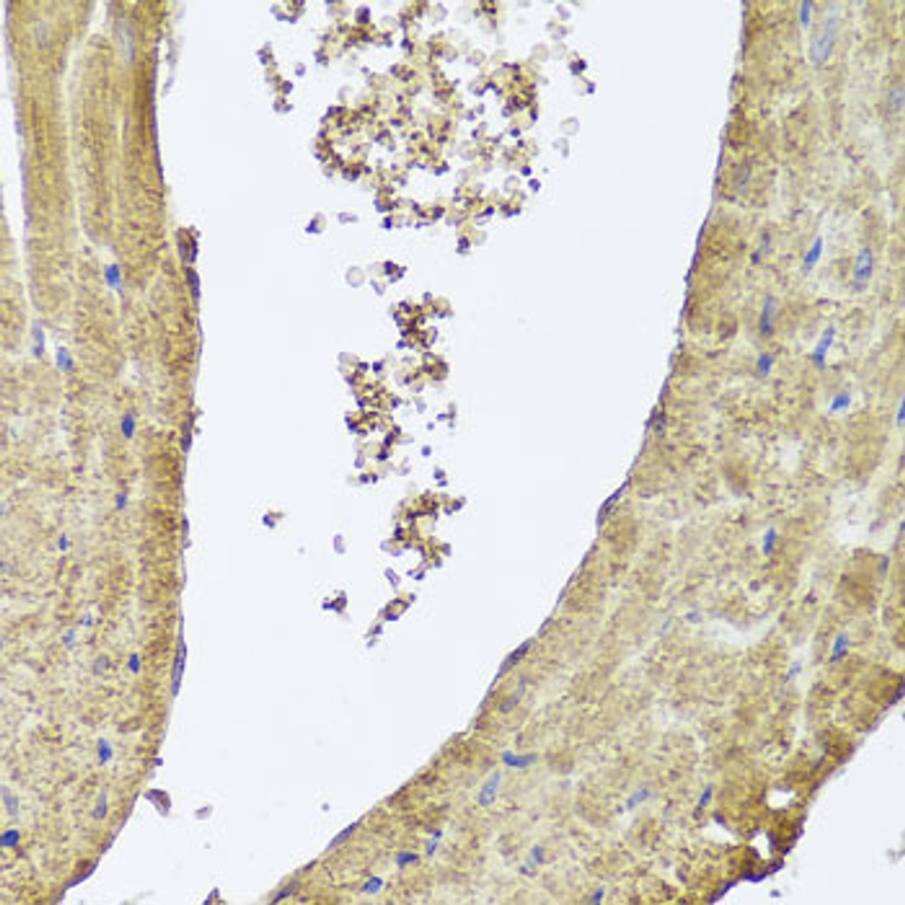 Immunohistochemistry of paraffin-embedded Mouse heart using PIK3C2A Polyclonal Antibody at dilution of  1:100 (40x lens).