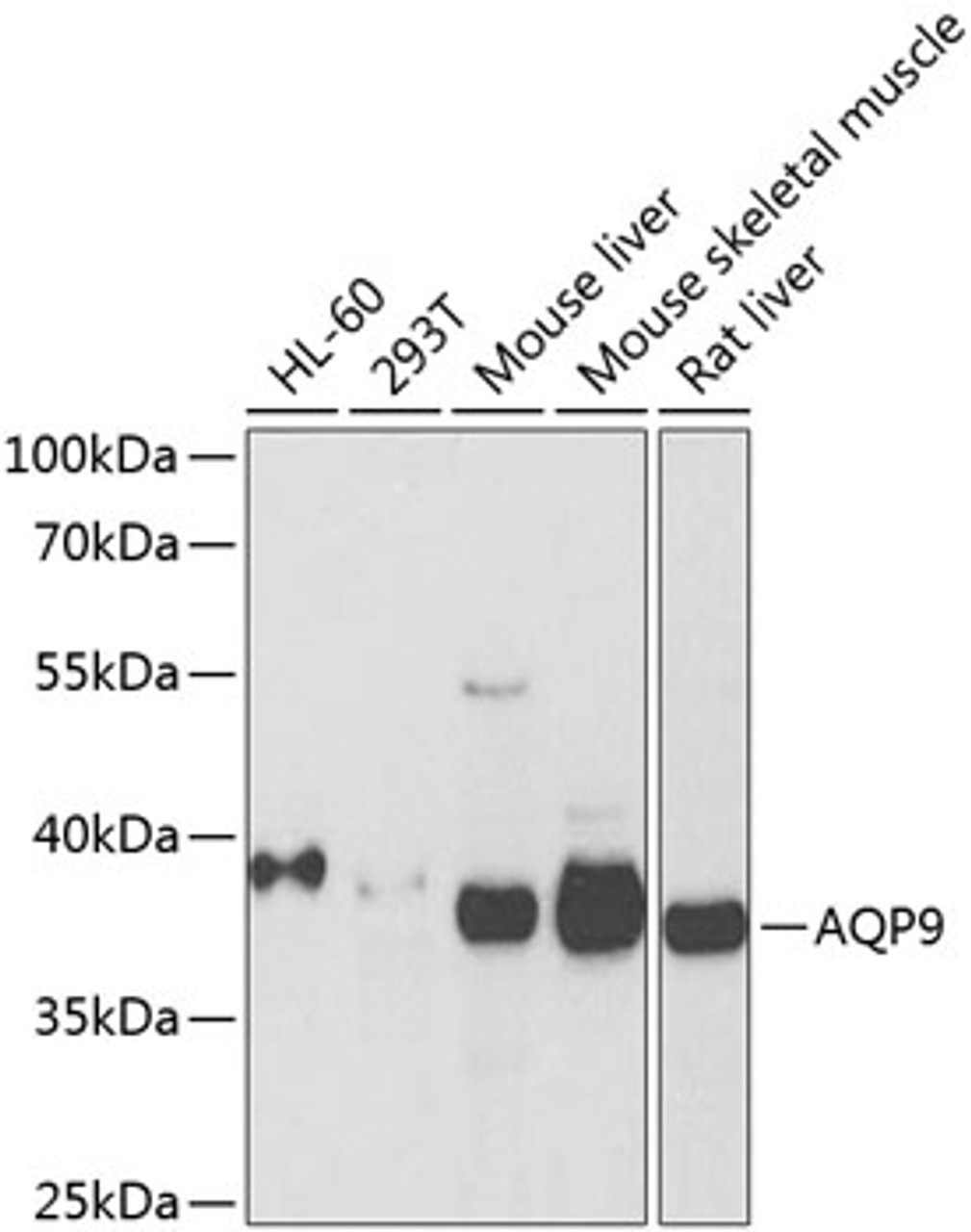 Western blot analysis of extracts of various cell lines using AQP9 Polyclonal Antibody at dilution of 1:1000.