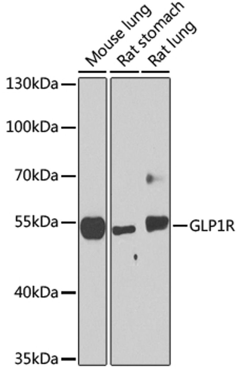 Western blot analysis of extracts of various cell lines using GLP1R Polyclonal Antibody at dilution of 1:1000.