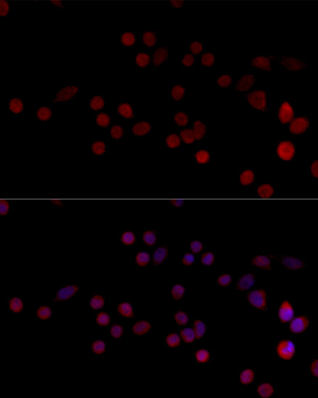 Immunofluorescence analysis of 293T cells using HNRPH3 Polyclonal Antibody at dilution of  1:100 (40x lens). Blue: DAPI for nuclear staining.