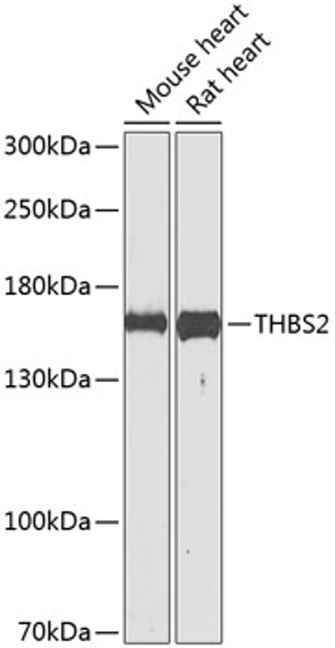 Western blot analysis of extracts of various cell lines using THBS2 Polyclonal Antibody at dilution of 1:1000.