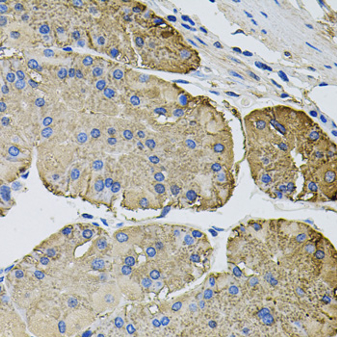 Immunohistochemistry of paraffin-embedded Human stomach using THBS2 Polyclonal Antibody at dilution of  1:100 (40x lens).