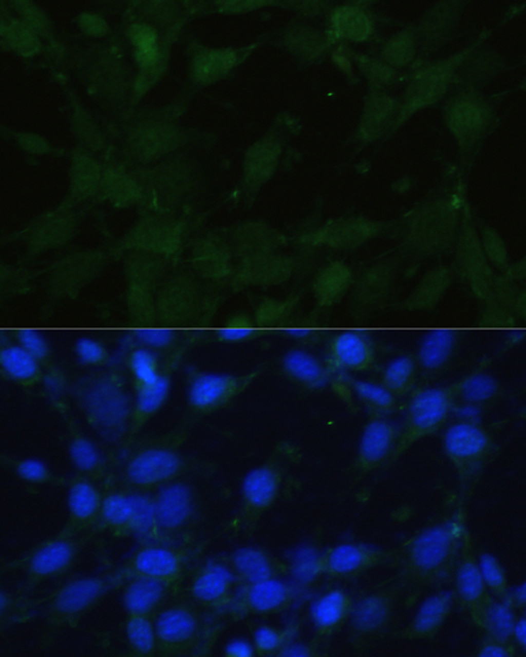 Immunofluorescence analysis of NIH/3T3 cells using TRPV1 Polyclonal Antibody at dilution of  1:100. Blue: DAPI for nuclear staining.