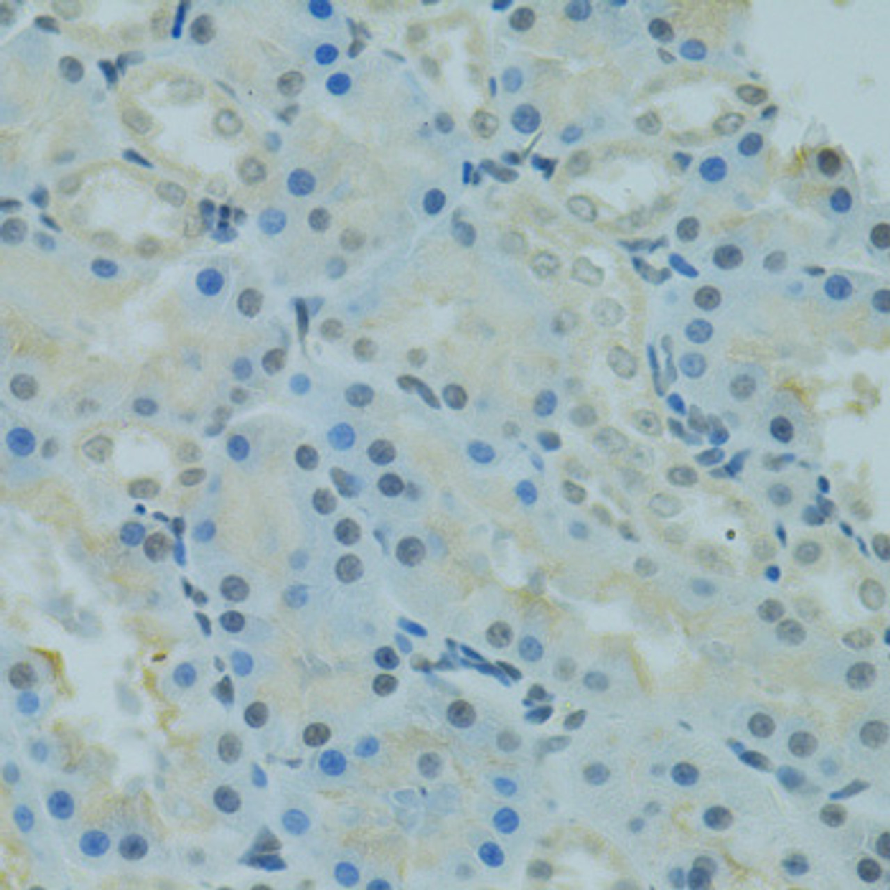 Immunohistochemistry of paraffin-embedded Rat kidney using PRDM2 Polyclonal Antibody at dilution of  1:100 (40x lens).