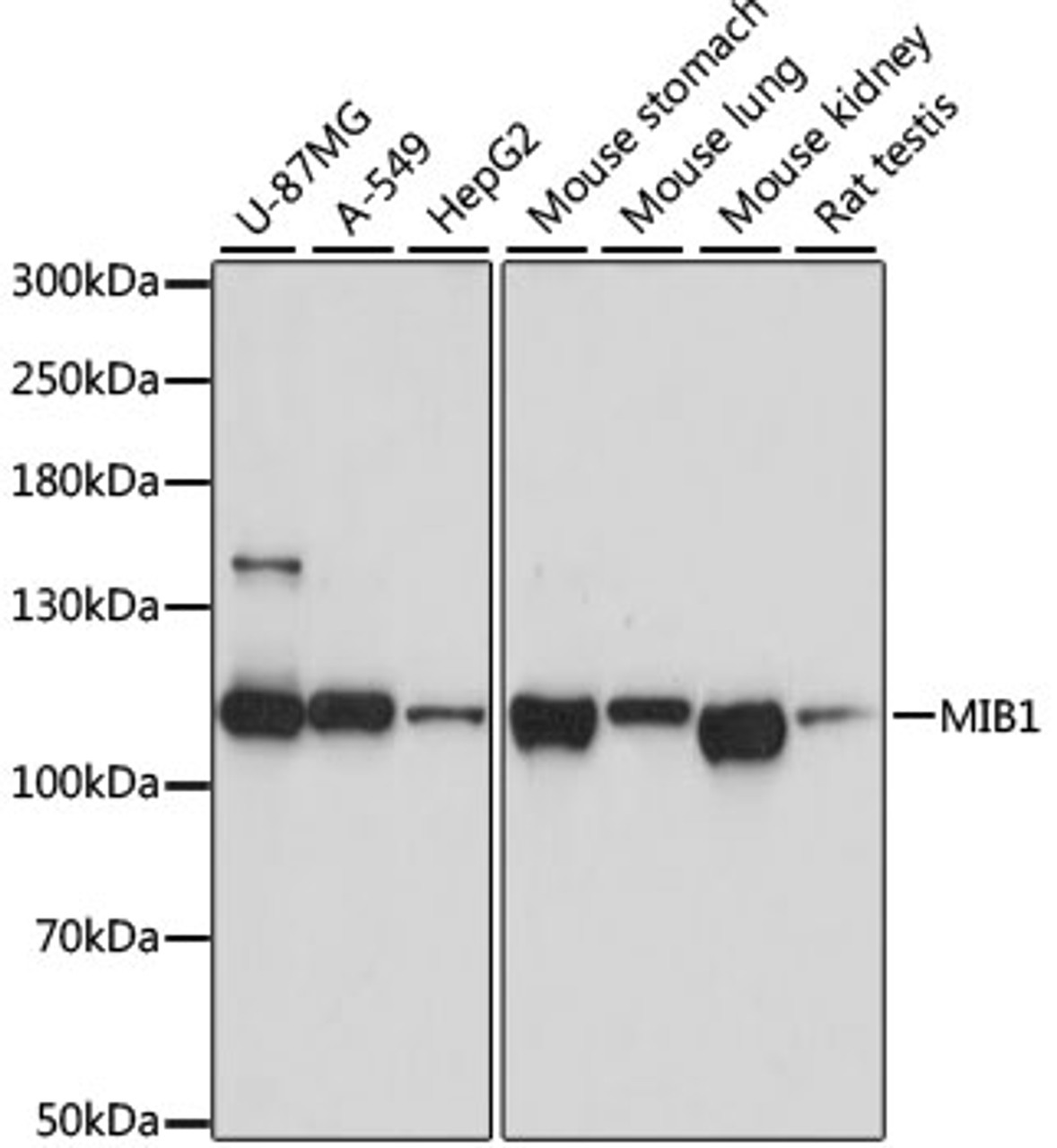 Western blot analysis of extracts of various cell lines using MIB1 Polyclonal Antibody at dilution of 1:1000.