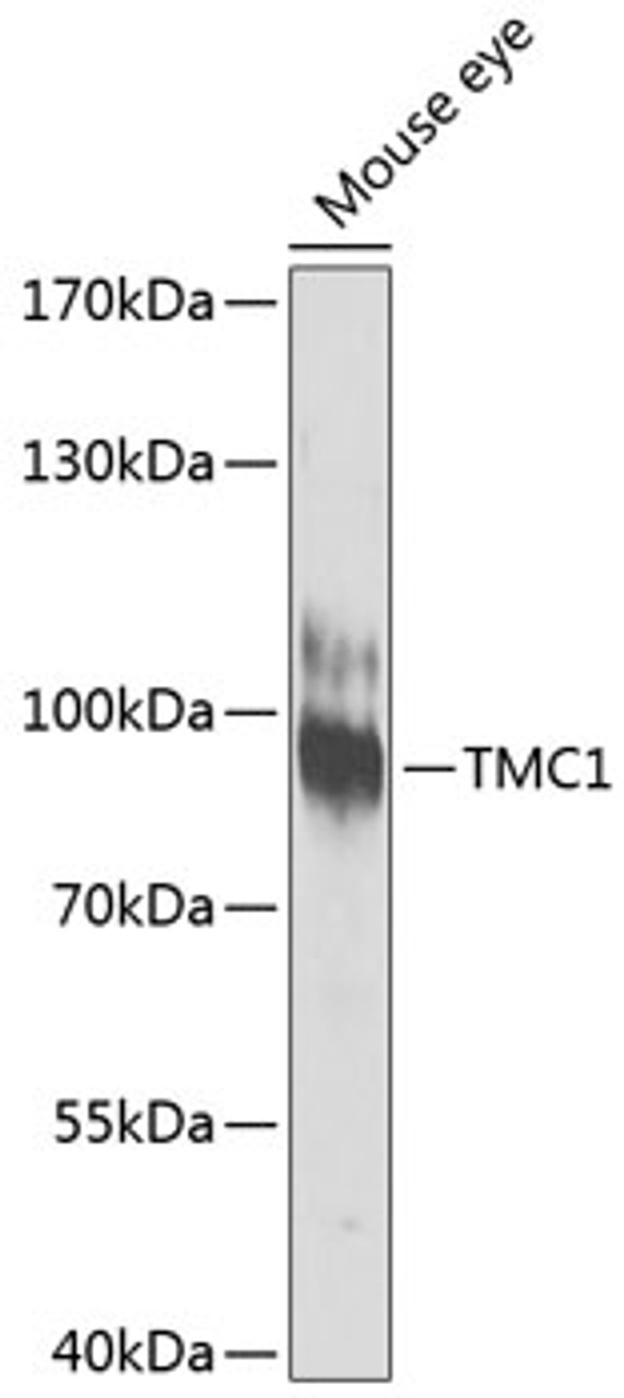 Western blot analysis of extracts of Mouse eye using TMC1 Polyclonal Antibody at dilution of 1:1000.