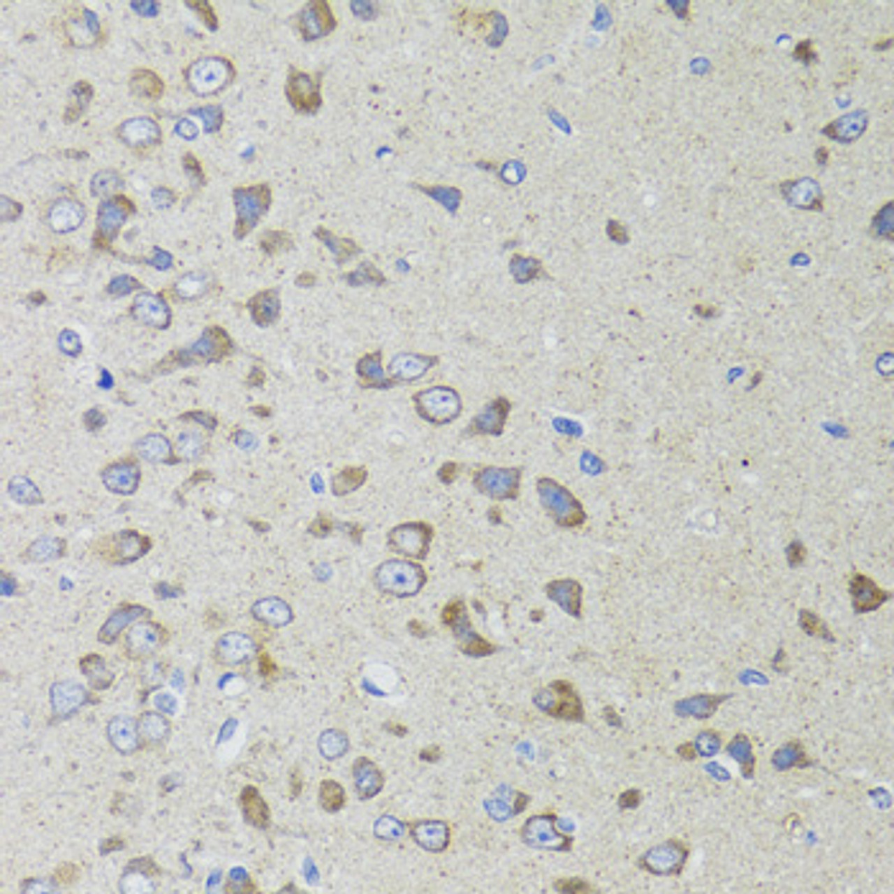 Immunohistochemistry of paraffin-embedded Rat brain using AIFM3 Polyclonal Antibody at dilution of  1:100 (40x lens).