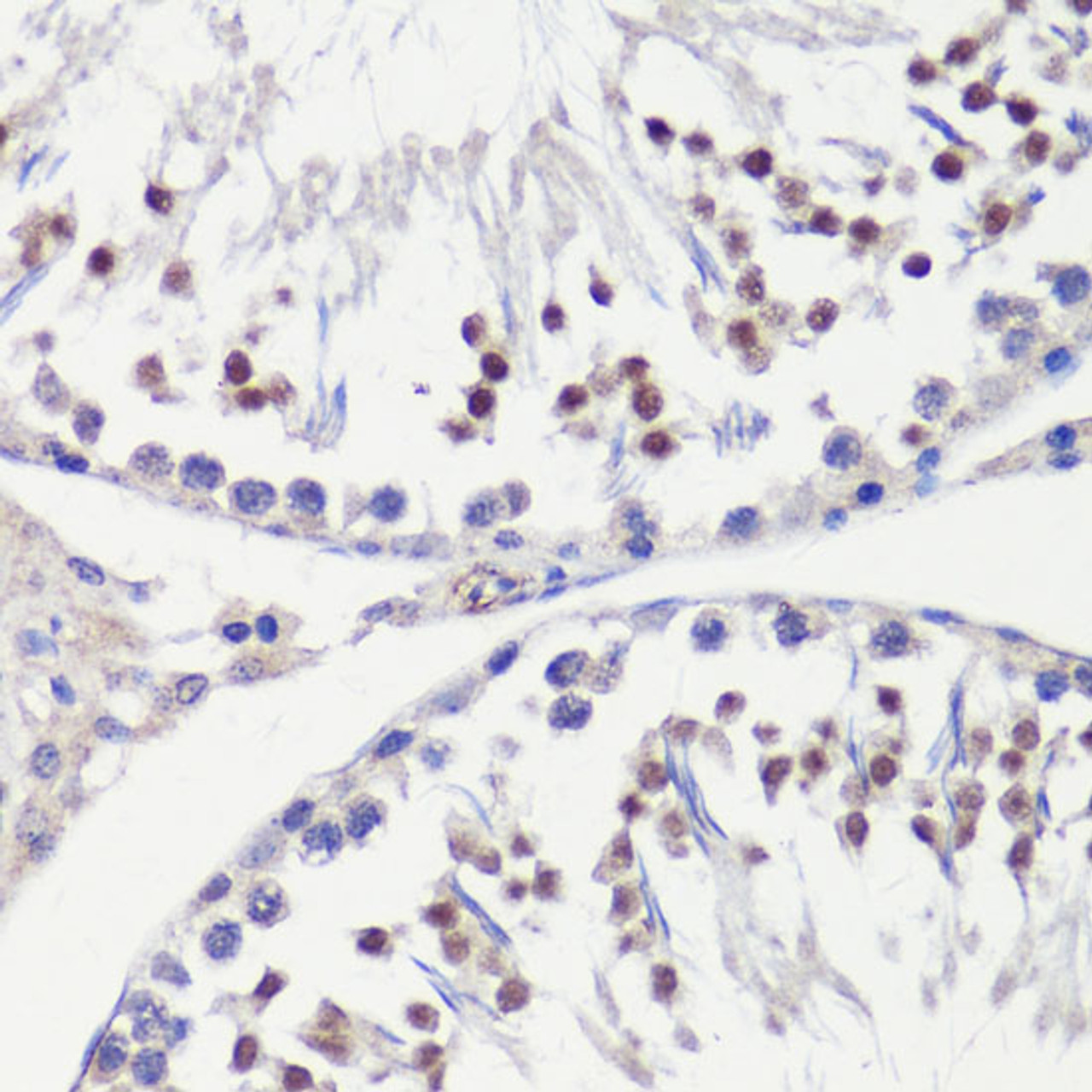 Immunohistochemistry of paraffin-embedded Rat testis using HFM1 Polyclonal Antibody at dilution of  1:100 (40x lens).