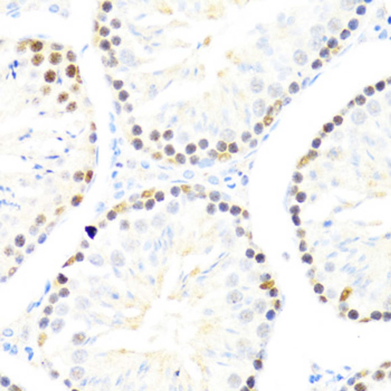 Immunohistochemistry of paraffin-embedded Mouse testis using DDX50 Polyclonal Antibody at dilution of  1:100 (40x lens).