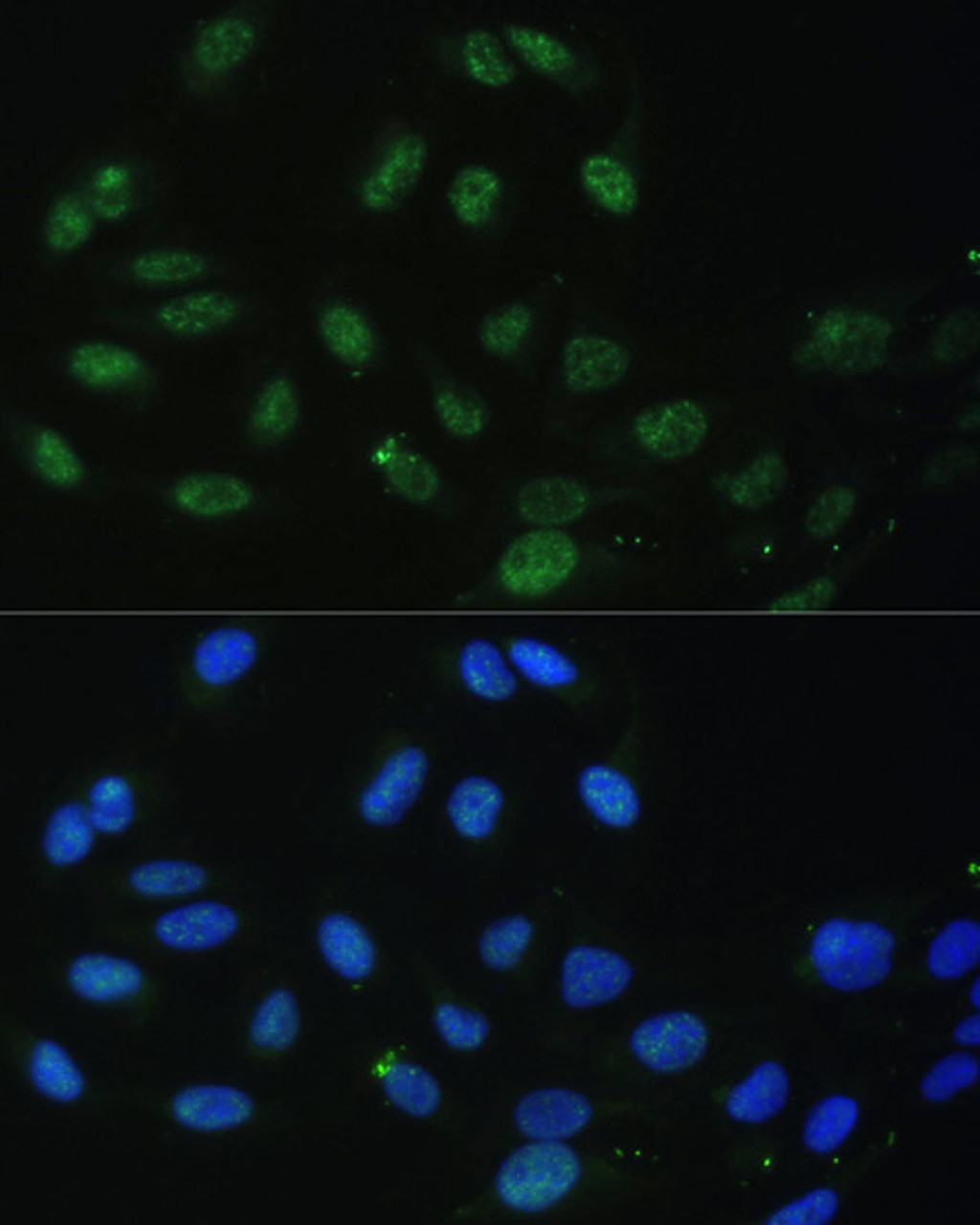 Immunofluorescence analysis of U-2 OS cells using DDX50 Polyclonal Antibody at dilution of  1:100. Blue: DAPI for nuclear staining.
