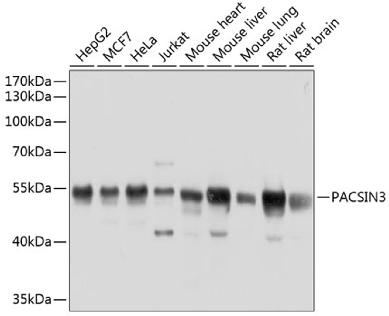 Western blot analysis of extracts of various cell lines using PACSIN3 Polyclonal Antibody at dilution of 1:1000.