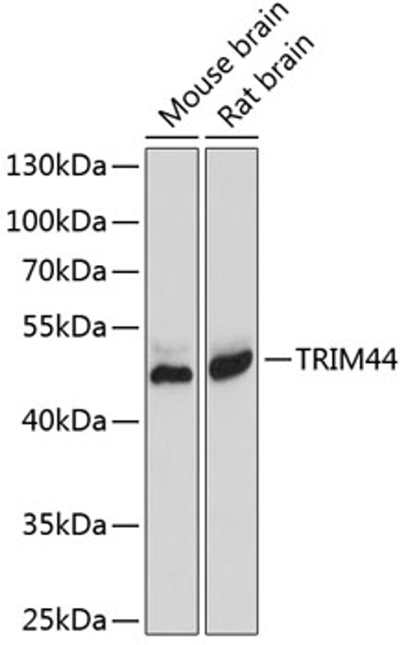 Western blot analysis of extracts of various cell lines using TRIM44 Polyclonal Antibody at dilution of 1:1000.