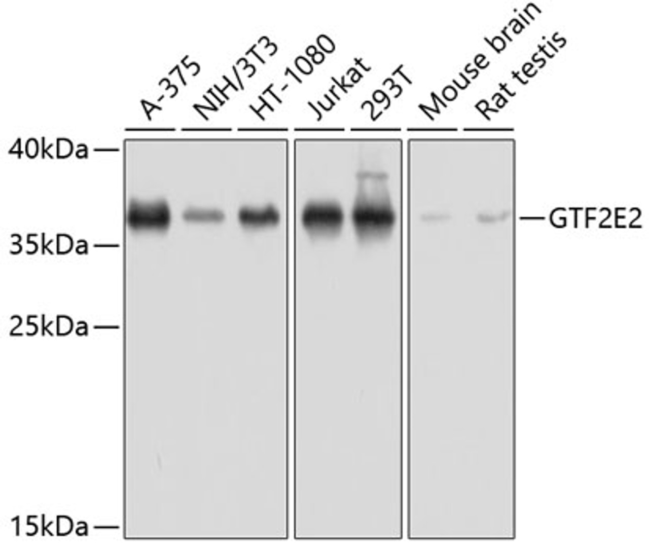 Western blot analysis of extracts of various cell lines using GTF2E2 Polyclonal Antibody at dilution of 1:1000.