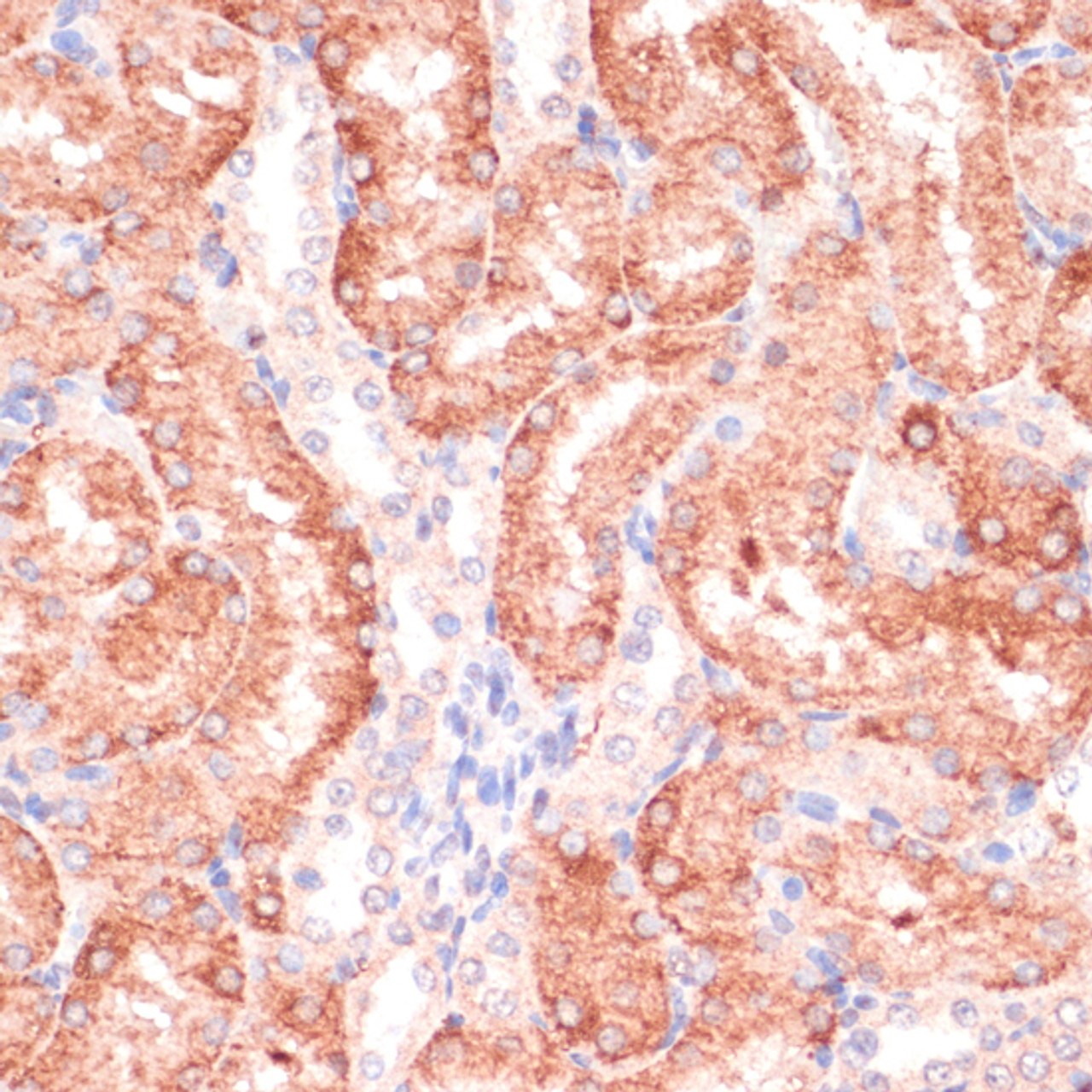 Immunohistochemistry of paraffin-embedded Rat kidney using RPIA Polyclonal Antibody at dilution of  1:100 (40x lens).