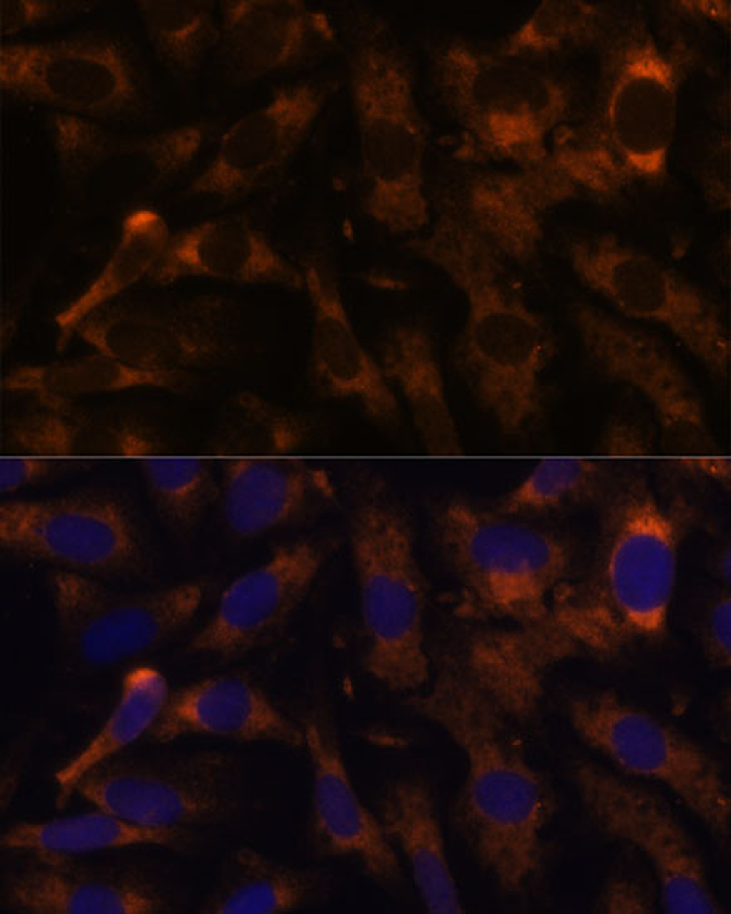 Immunofluorescence analysis of U-2 OS cells using SUCLG2 Polyclonal Antibody at dilution of  1:100 (40x lens). Blue: DAPI for nuclear staining.