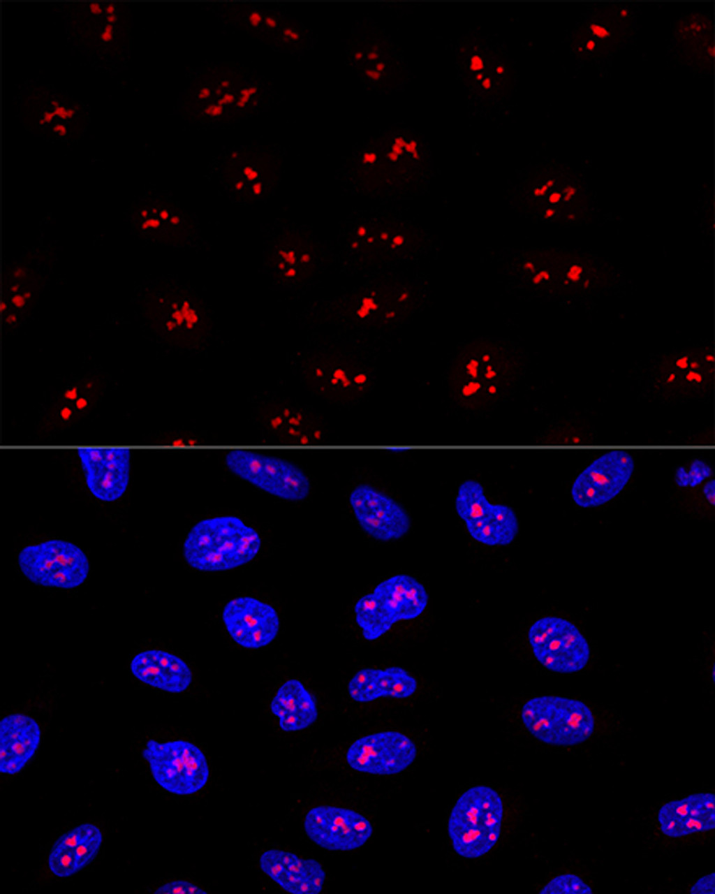 Confocal immunofluorescence analysis of U2OS cells using EBNA1BP2 Polyclonal Antibody at dilution of  1:200. Blue: DAPI for nuclear staining.